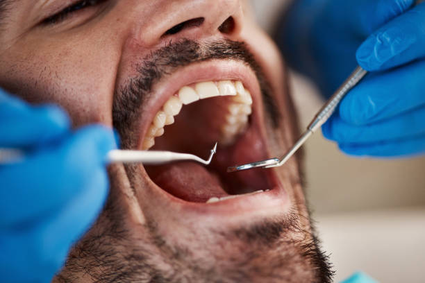 Best Emergency Dental Services for Seniors in Hill City, KS